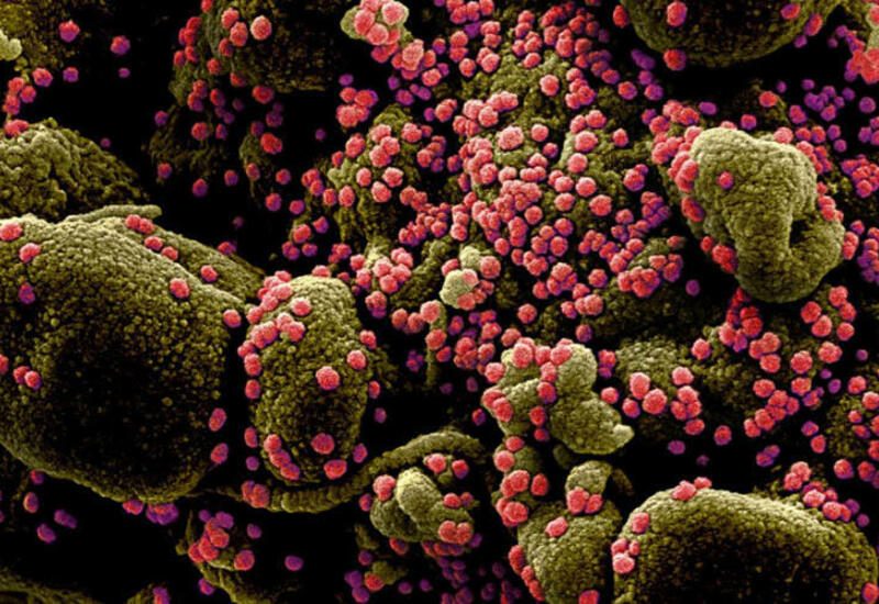Koronavirus kimlərdə xroniki xəstəliyə çevrilir?