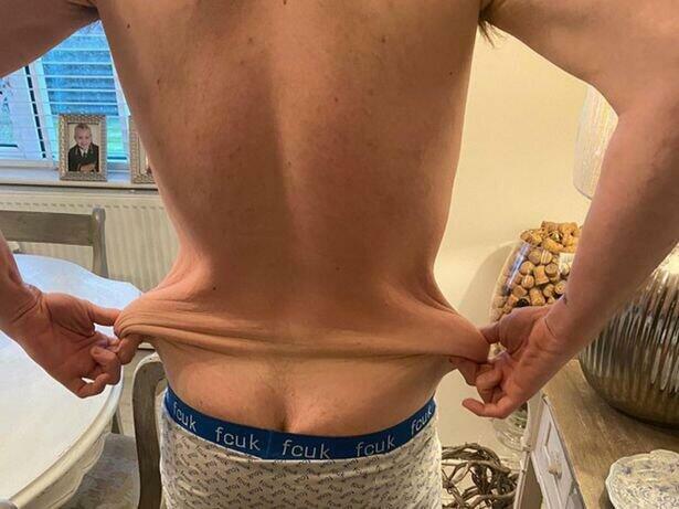90 kilo arıqlayıb peşman oldu