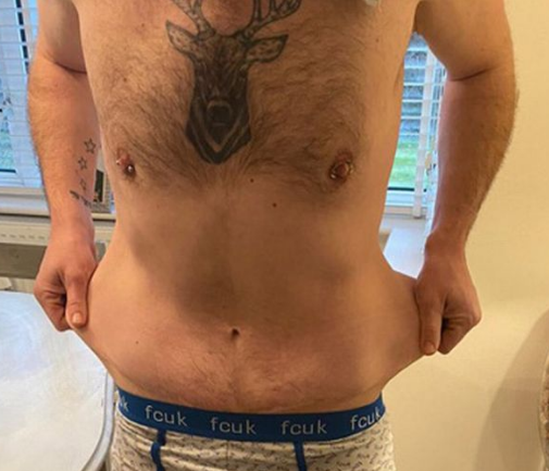 90 kilo arıqlayıb peşman oldu