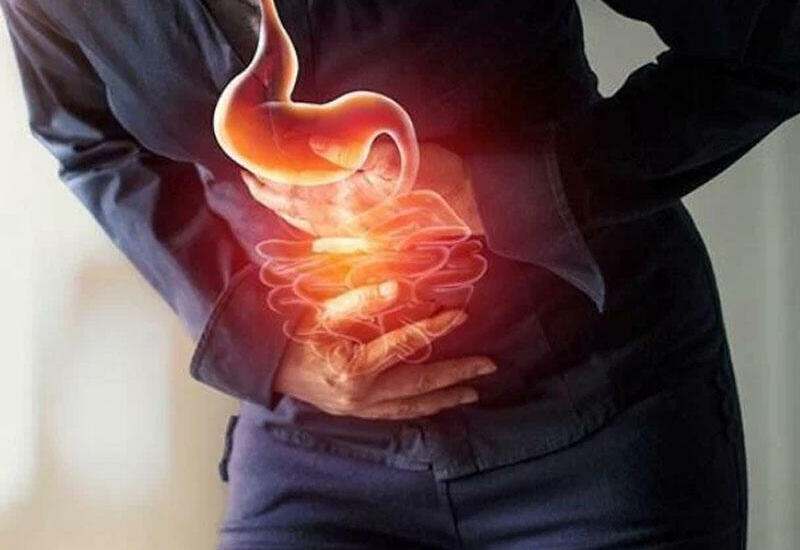 Mədə yanması nədir?