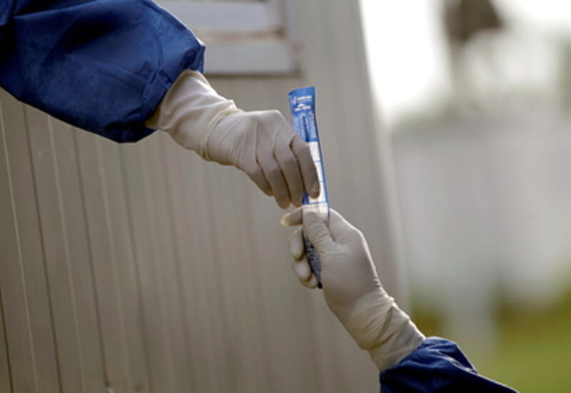 Ученые назвали срок сохранения антител к коронавирусу в организме