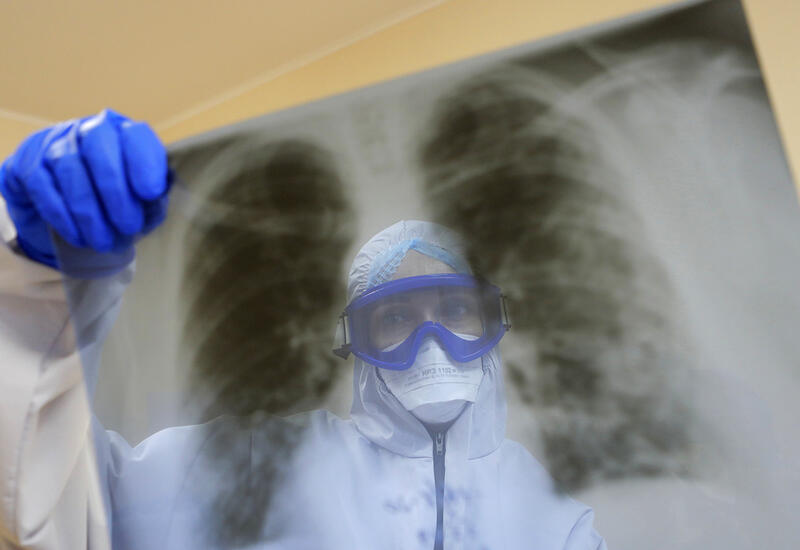 106-летняя женщина вылечилась после заражения «дельта»-штаммом COVID-19