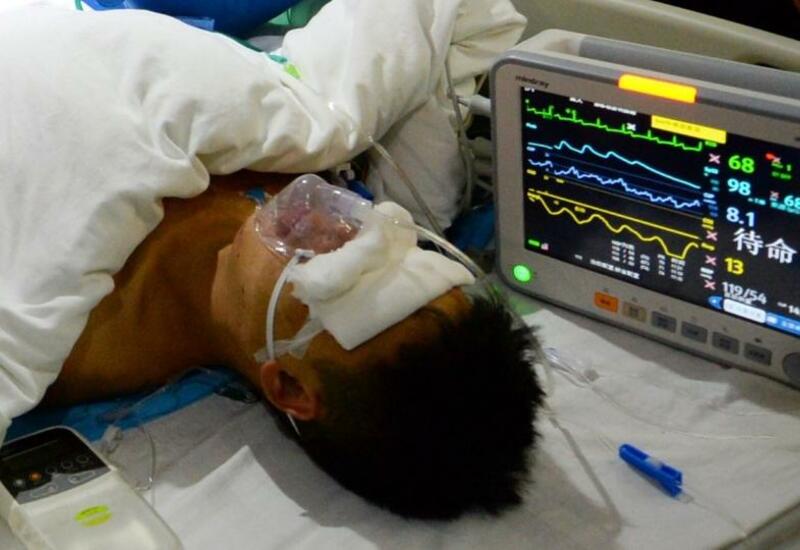 В Китае зафиксировали случай заболевания сибирской язвой