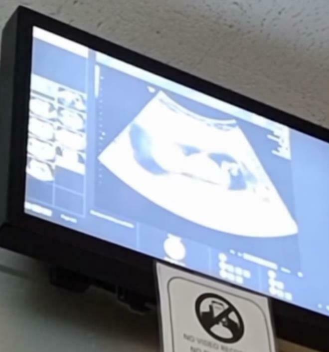 "Hədəfim 17 uşaq dünyaya gətirməkdir" - İlk övladını 14 yaşında dünyaya gətirən 11 uşaq anası