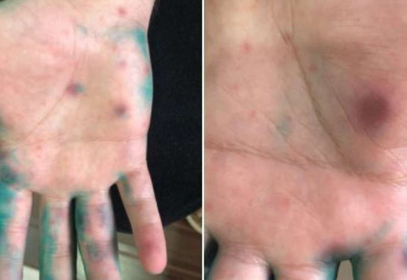 Azərbaycanda bu virus yayılır