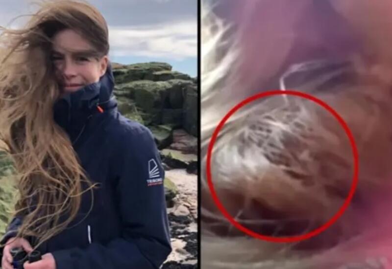 Спасенная женщиной птица свила гнездо у нее в волосах