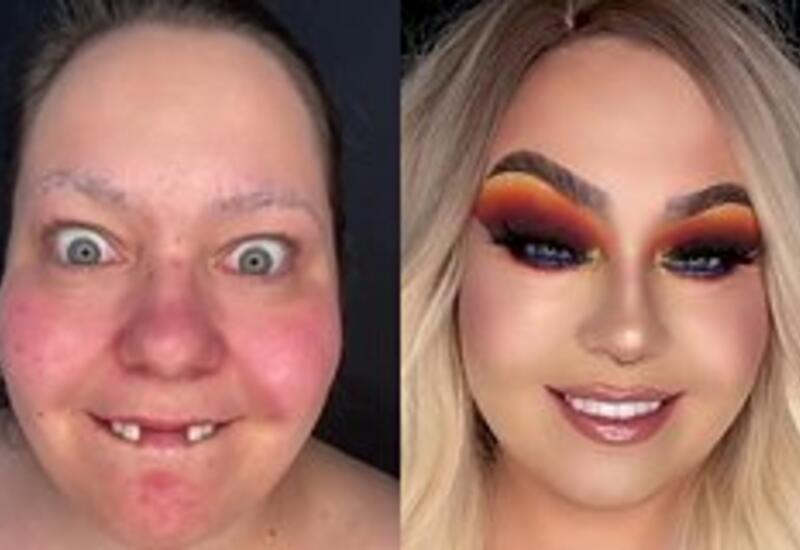 Девушка без передних зубов изменилась до неузнаваемости с помощью макияжа