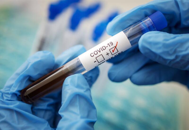В Азербайджане выявлены новые случаи заражения COVID-19