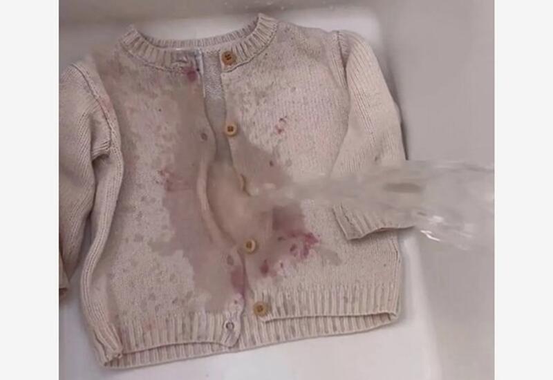 Блогерша показала спасительный для мам трюк по устранению пятен ягод с одежды