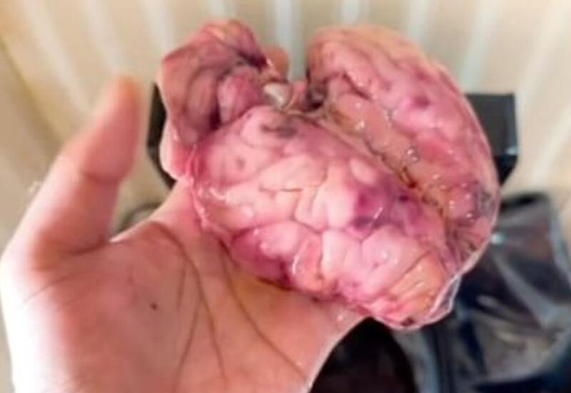 Любитель испорченной еды рассказал о самом отвратительном блюде в жизни