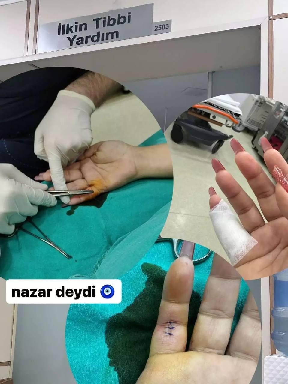 Aktrisa Xəyalə təcili əməliyyat olundu