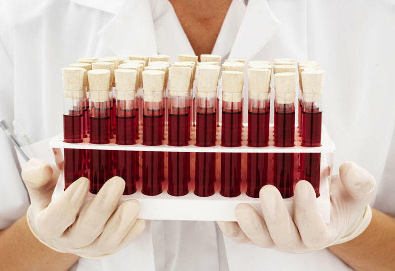 Kimlər qan verə bilməz?