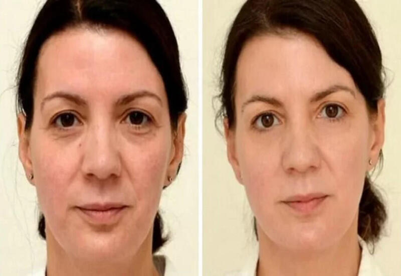 8 stəkan su nələri dəyişə bilər?