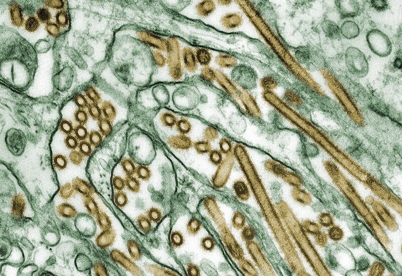 ВОЗ подтвердила заражение человека птичьим гриппом A(H5N1)