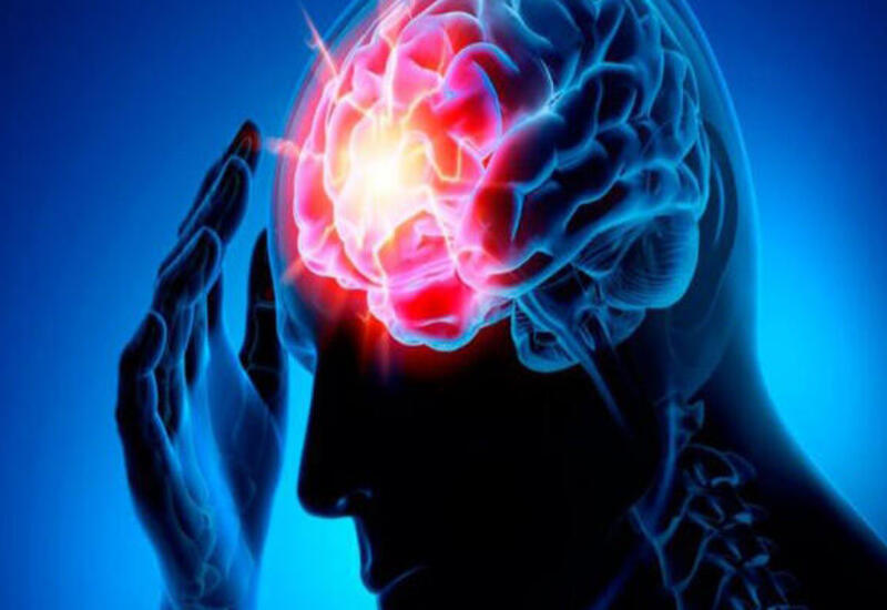 Названа группа людей наиболее подверженная инсульту