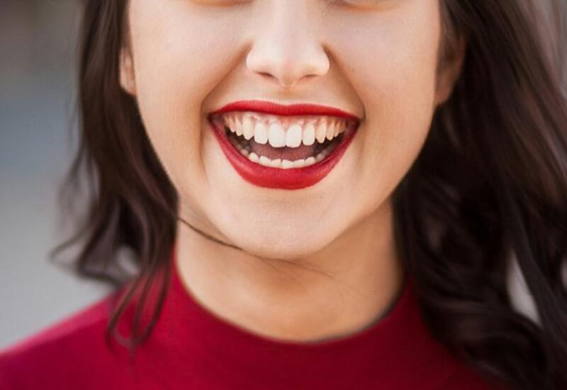 Стоматолог предупредил об ошибке после отбеливания зубов