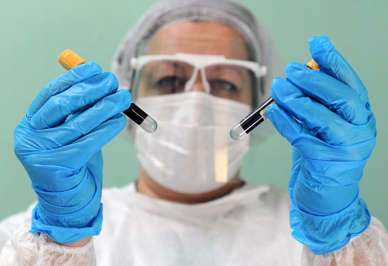 Обнаружен новый биомаркер слабоумия в крови человека