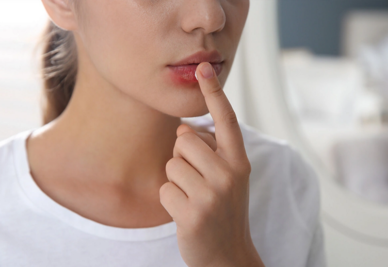 Herpes virusu: Altsheymer xəstəliyi ilə mübarizədə dost, yoxsa düşmən?