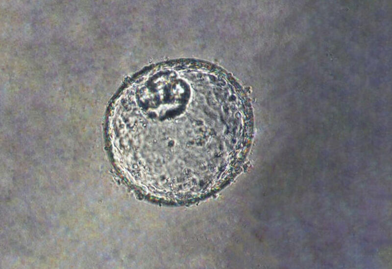 Создан новый дешевый способ выращивания мини-органов для опытов