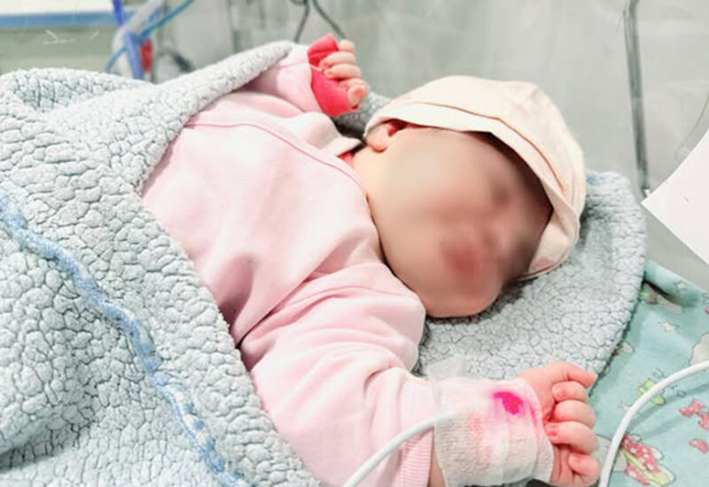 Bakıda 6 kiloqramlıq körpə doğuldu