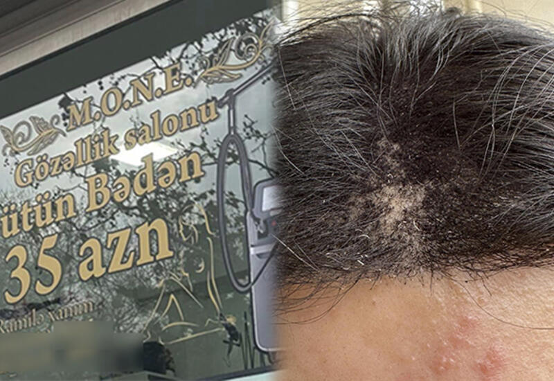 Gözəlləşmək üçün salona gedən qadının başına iş gəldi