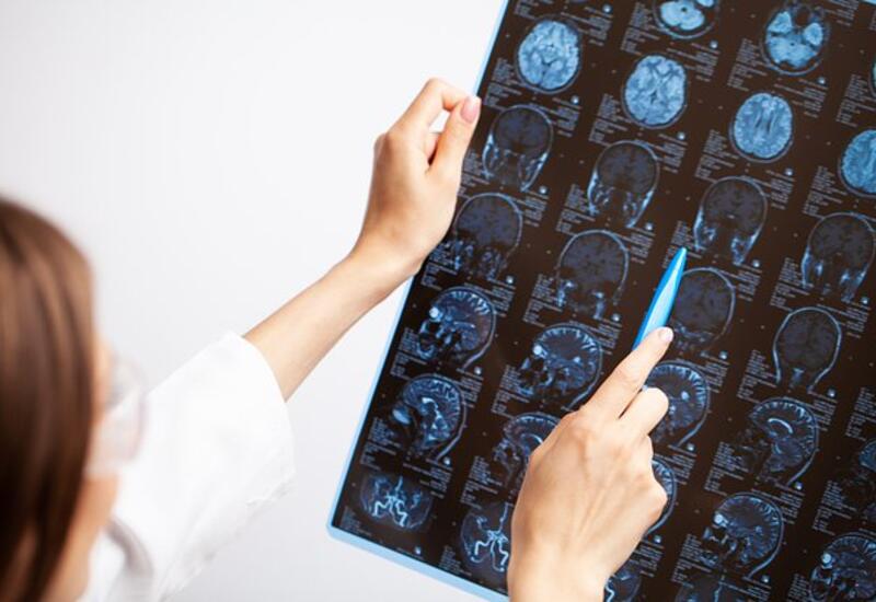 ИИ оказался бесполезен для диагностики рака