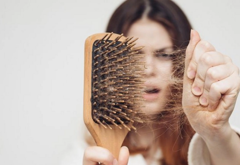 Saçı tökülənlər,