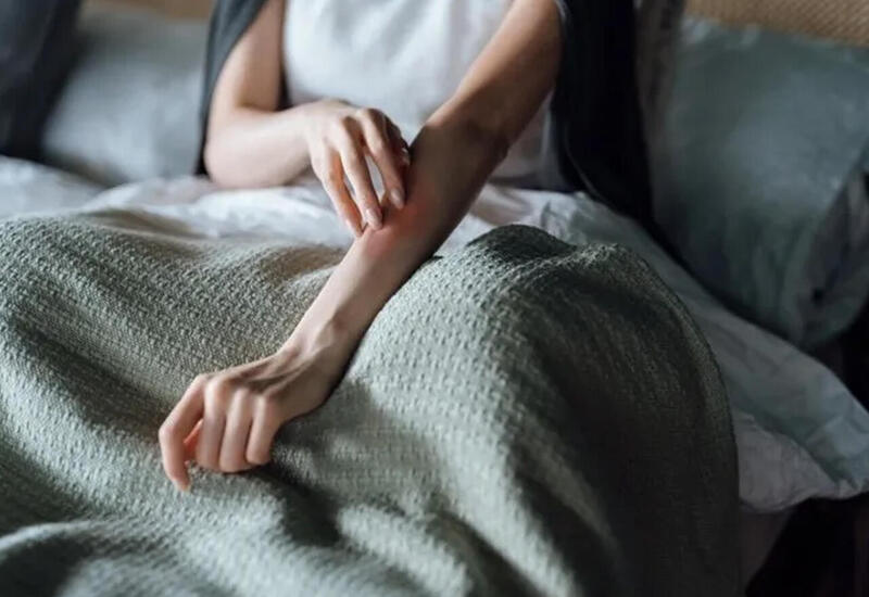 Qaşınmanın səbəbi bu imiş