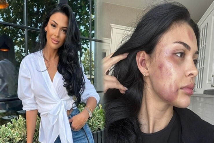 Razini döyməkdə təqsirləndirilən vəzifəli şəxsə HÖKM OXUNDU