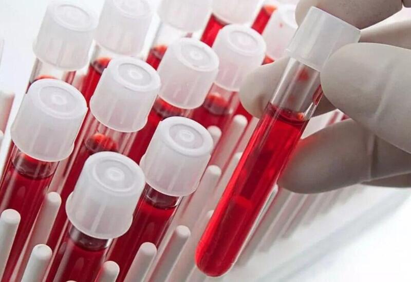 Ən ağıllı insanlar bu qan qrupundan olurlar