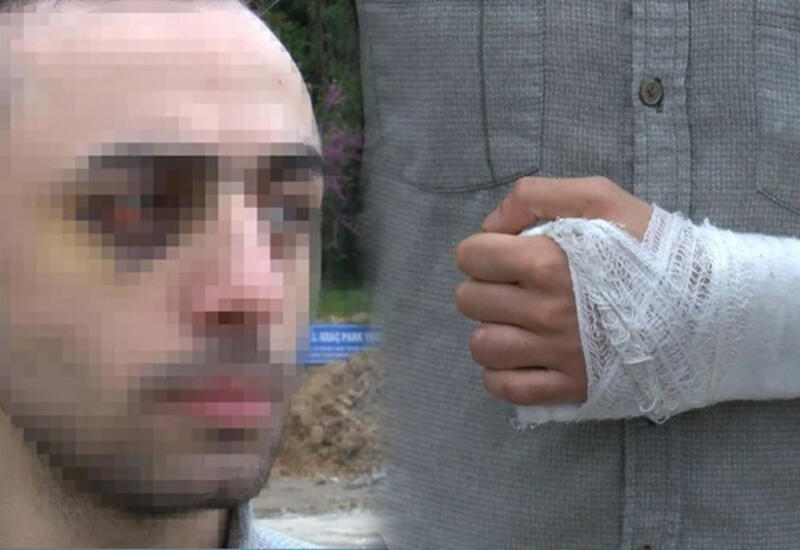 Türkiyədə azərbaycanlı tələbəni döyüb videoya çəkənlərə