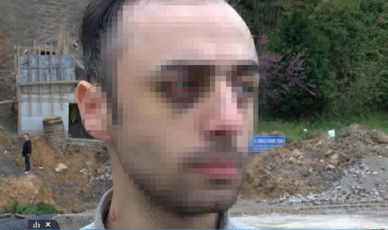 Türkiyədə azərbaycanlı tələbəni döyüb videoya çəkənlərə