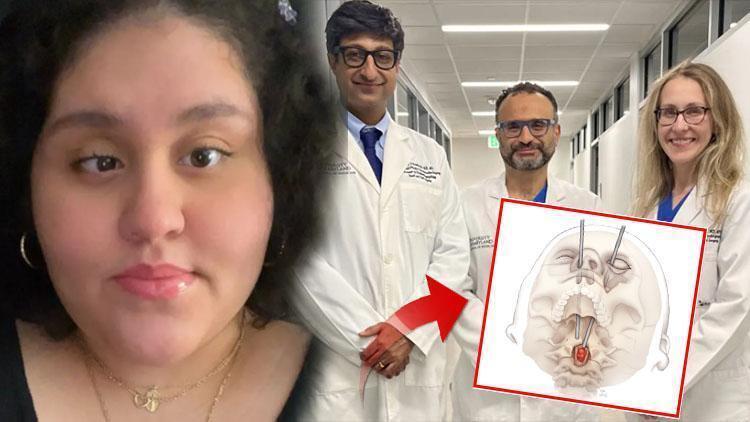 Bədənindəki şiş xəstənin gözündən çıxarıldı