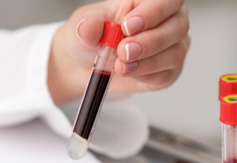 Alimlər süni qan qrupu yaratdı