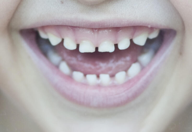 Названы пять способов, которые помогают прорезаться зубам у ребенка