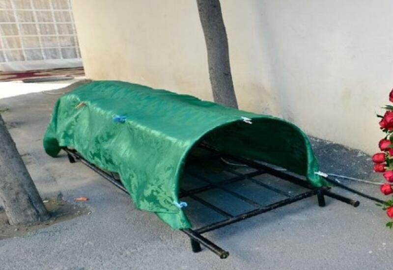 Ayağı amputasiya olunan azərbaycanlı aktyor vəfat etdi