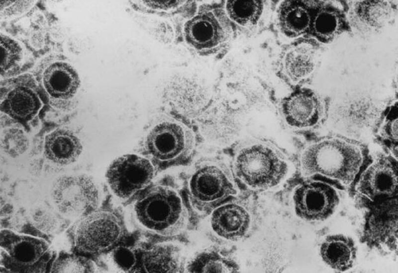 Ученые «побороли» рак кожи с помощью вируса герпеса