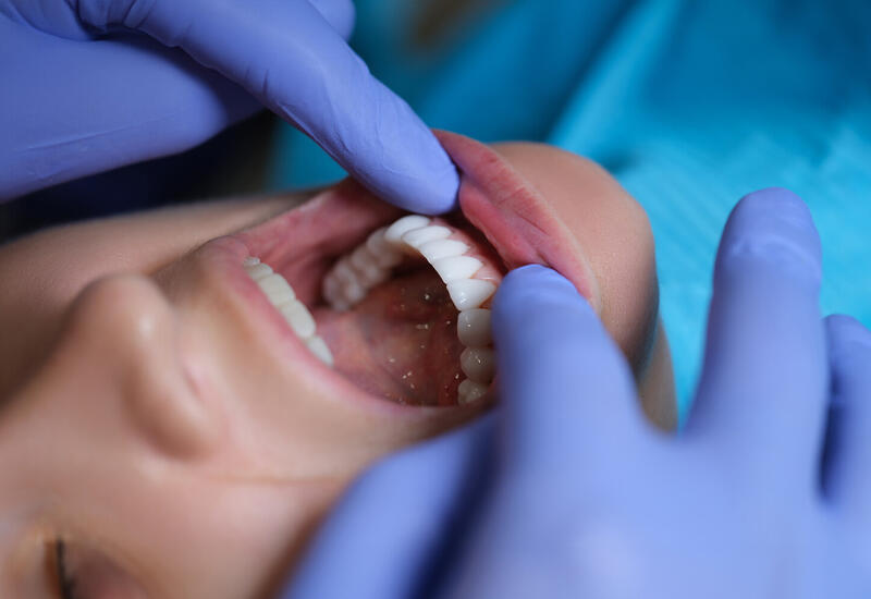 Названы продукты, снижающие риск воспаления десен