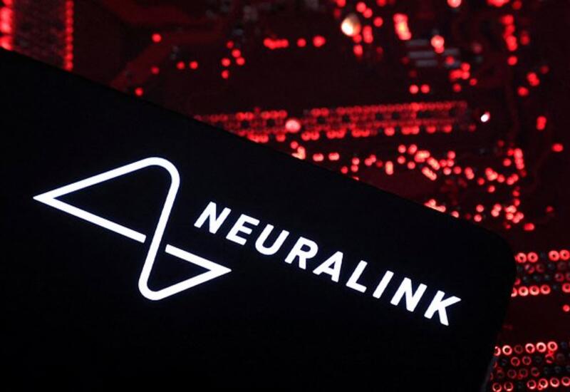 Neuralink приступает к тестированию нейрочипа для чтения мыслей