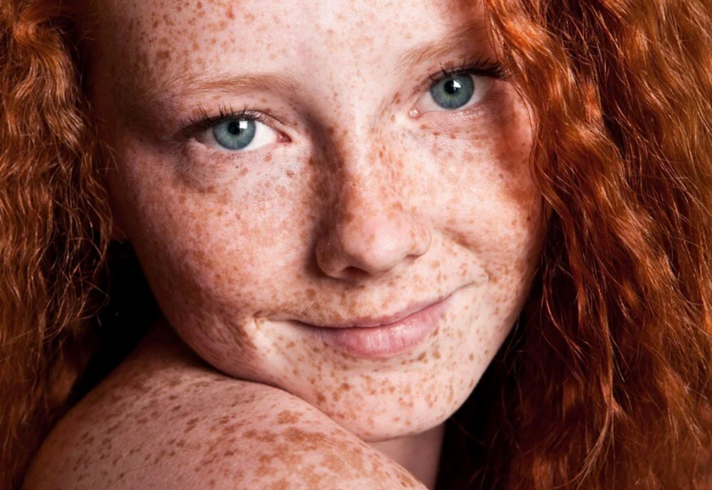 Çilləri belə yox edin