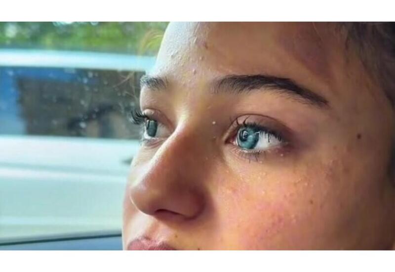 Bakıda 13 yaşlı dilənçi qız gözəlliyi ilə