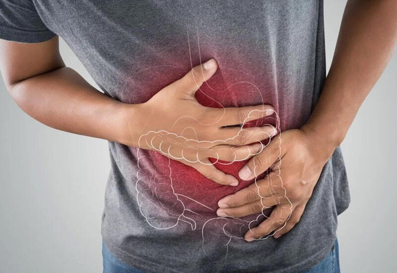 Bu simptom bağırsaq xərçənginin əsas xəbərçisidir