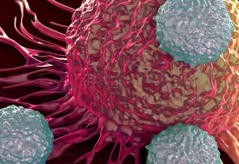 Gənclər arasında ən çox bu xərçəng növü yayılmağa başladı