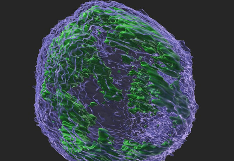 Ученые уничтожили раковые клетки, лишив их энергии