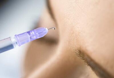 Хирург рассказал о рисках использования филлеров в зоне лица