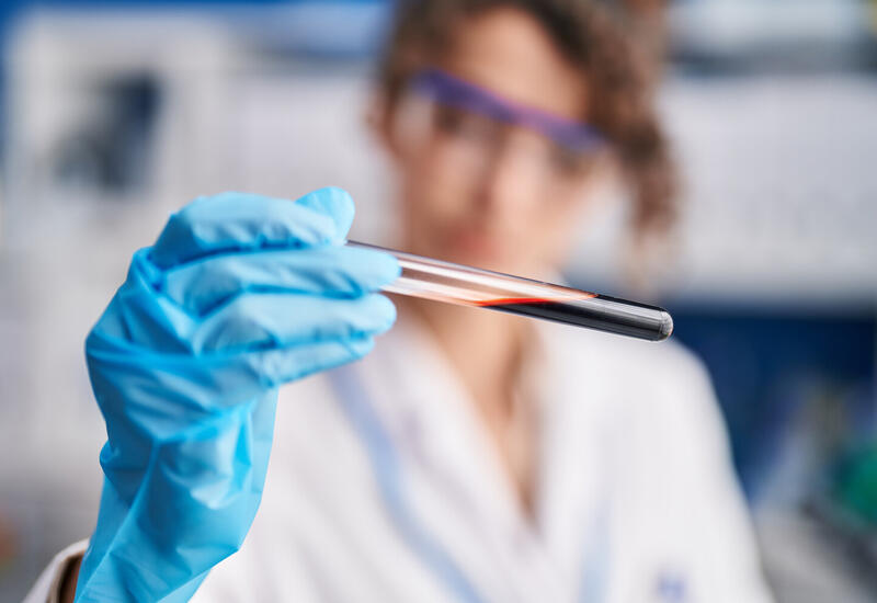 Найдена неочевидная причина нарушения работы иммунной системы