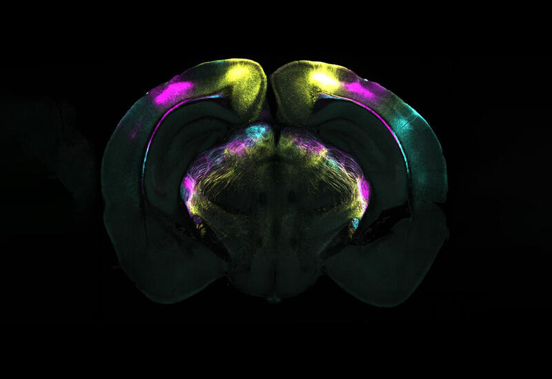 Назван неожиданный способ восстановить все детские воспоминания