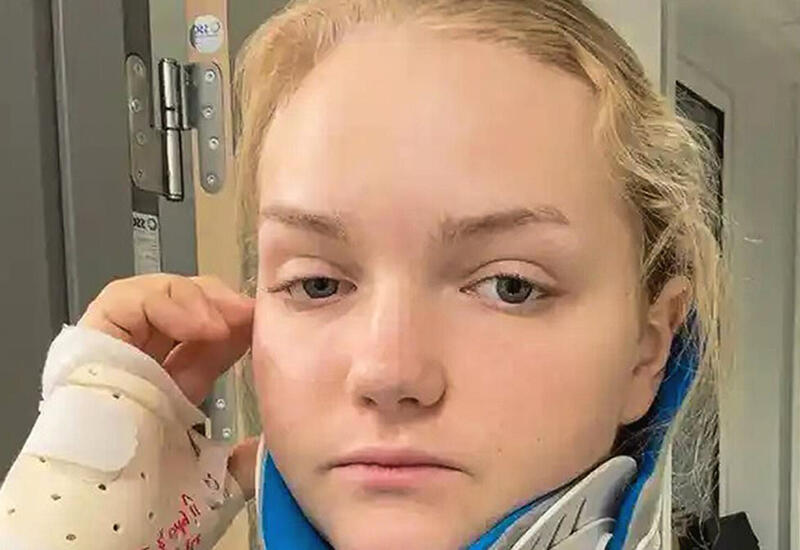 Лев стащил женщину с лошади во время сафари и прокусил ей шею