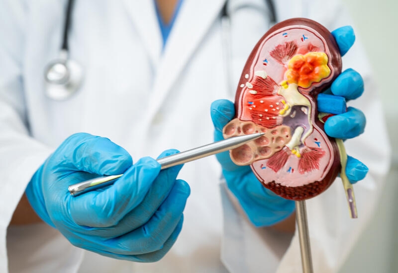 Названы неочевидные признаки проблем с почками