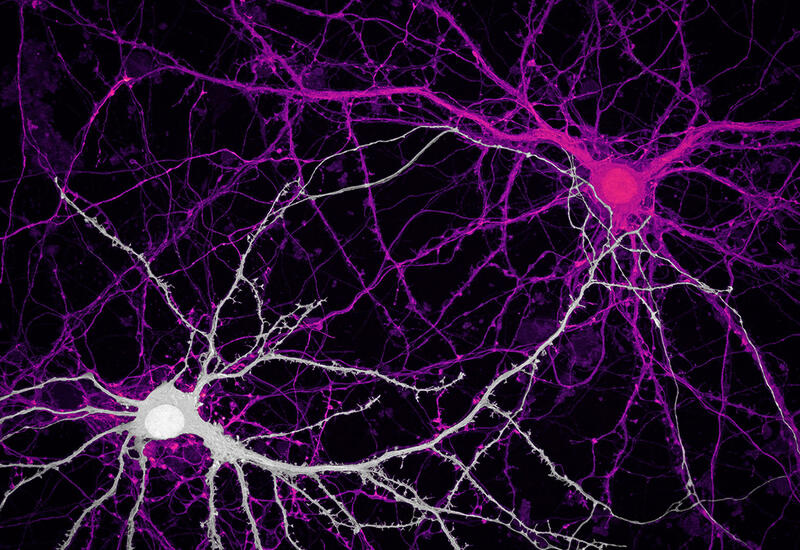 В мозге впервые обнаружены скрытые связи